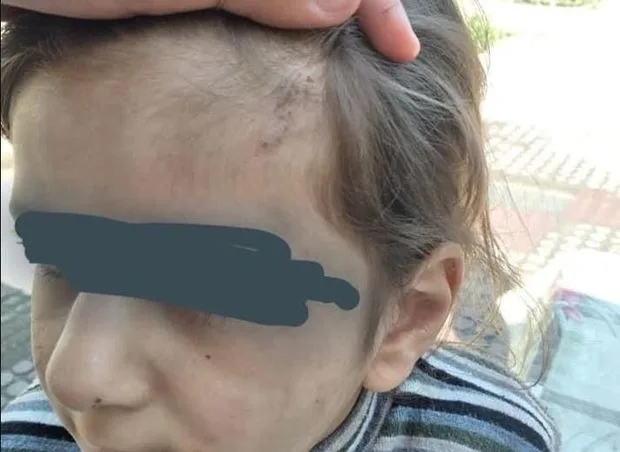 Atası tərəfindən şiddətə məruz qalan uşaqla bağlı məsələ DİN-in nəzarətindədir