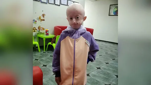 On yaşlı qız qocalıqdan öldü - FOTO