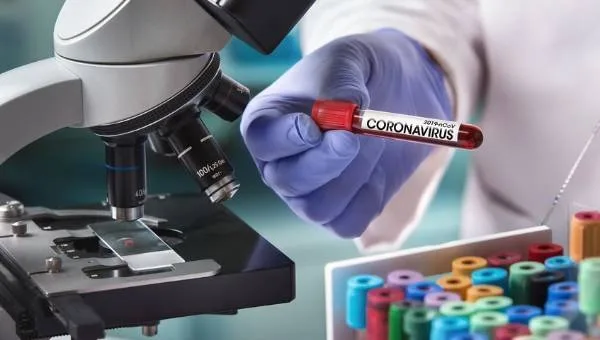 Azərbaycanda koronavirusa yoluxanların sayı açıqlandı - 32 nəfər vəfat edib