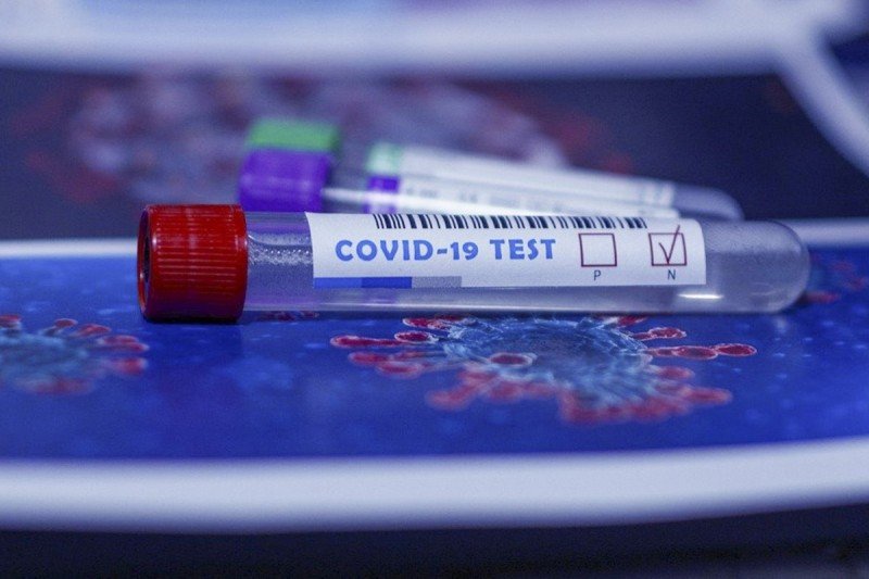 Rusiyada koronavirusdan ölənlərin sayı 185 mini keçdi
