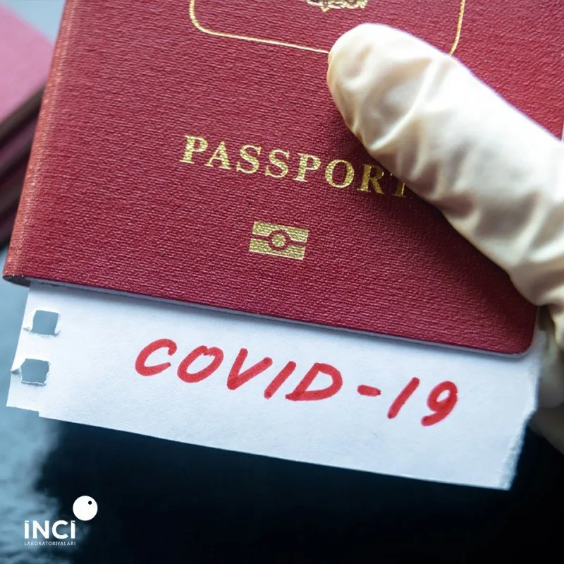 Penitensiar xidmət: “Məhkumlarla görüşə gələn şəxslərdən COVID-19 pasportu tələb olunur”