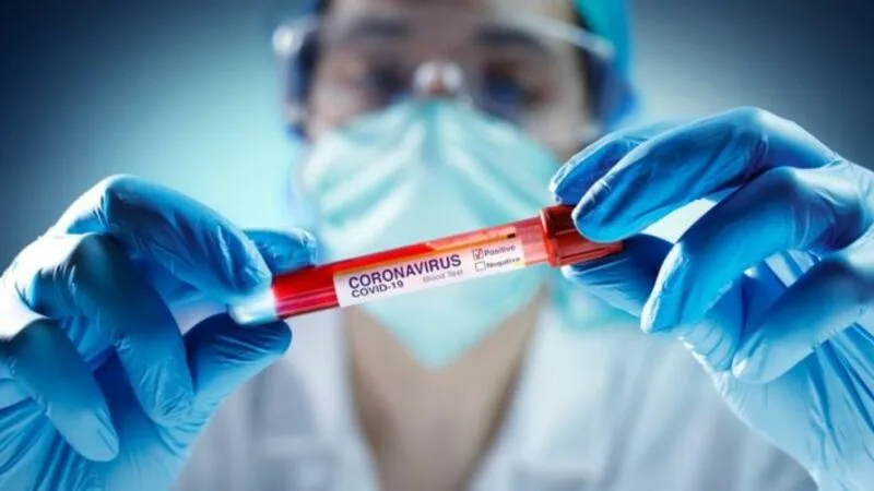Yoluxma AZALDI, ölüm sayı ARTDI