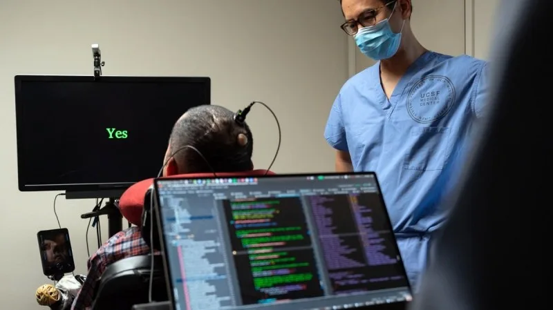 İflic olan pasient beyin implantı sayəsində danışıb