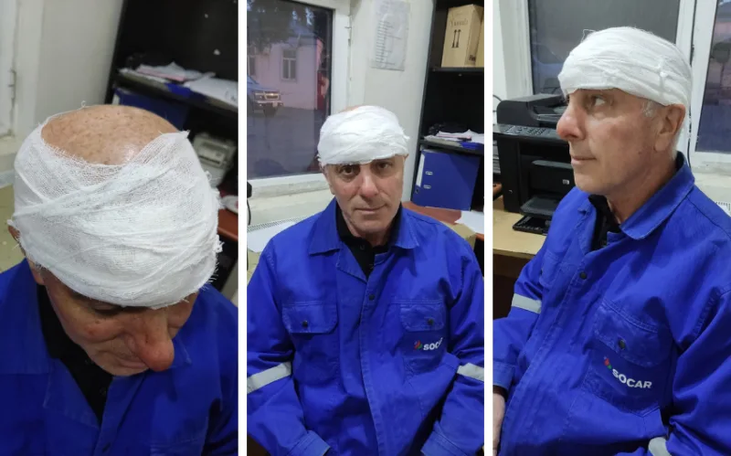 “Azəriqaz”ın əməkdaşı DÖYÜLDÜ