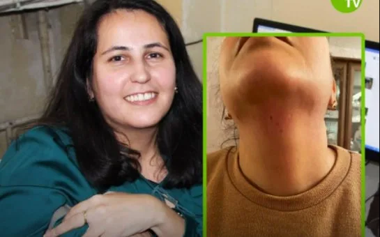 Jurnalistin boğazına BIÇAQ ÇƏKDİ - DİN araşdırmaya başladı - FOTO