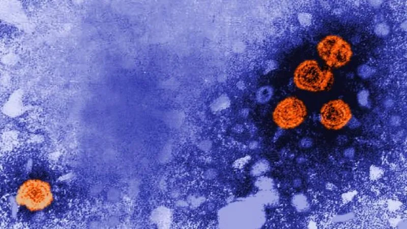 YENİ TƏHLÜKƏ: mənşəyi bilinməyən virusa 15 nəfər yoluxdu
