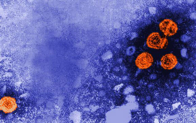 Müəmmalı hepatitdən 10 uşaq öldü