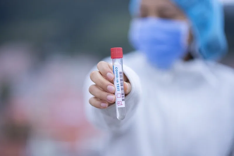 Azərbaycanda koronavirusa yoluxma ilə bağlı icra olunan test sayı 7 milyonu keçdi