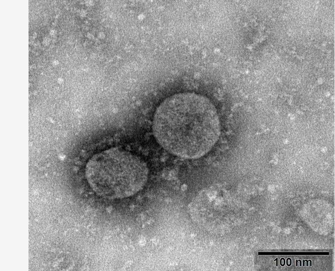 Bu virus xərçəng hüceyrələrini öldürür