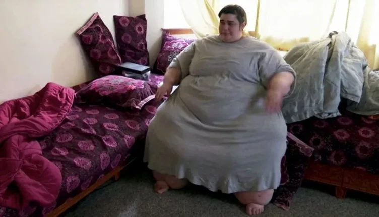 200 kilo arıqladı - Son halı şoka saldı - FOTO