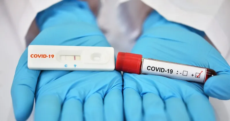 PCR-test tələbi ləğv edilir - Bu gündən etibarən...