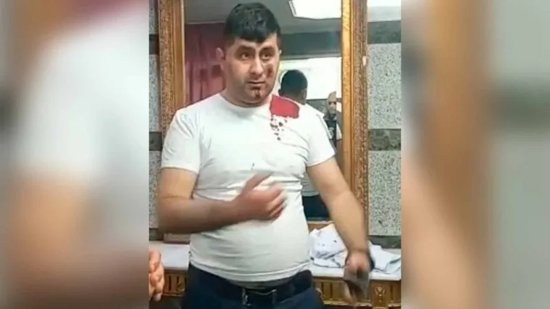 Terrorçunu zərərsizləşdirən Vasifin əməliyyatdan sonrakı FOTOSU