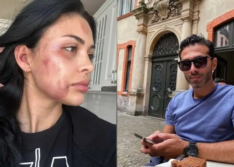 Ziyadan model sevgilisinin döyülməsinə REAKSİYA - FOTOLAR