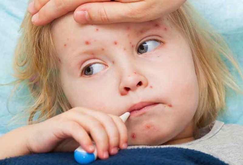 Qızılcadan qorunmağın ən effektiv yolu...