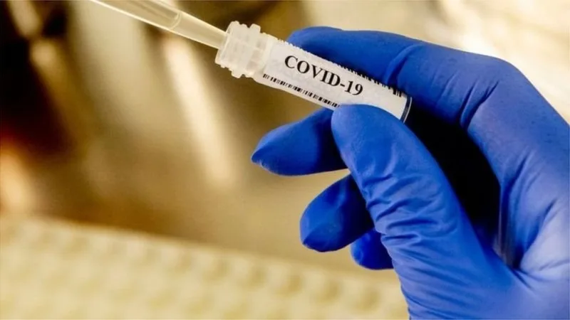 COVİD-19 pandemiyası ilə bağlı mübarizə xərcləri azaldılıb