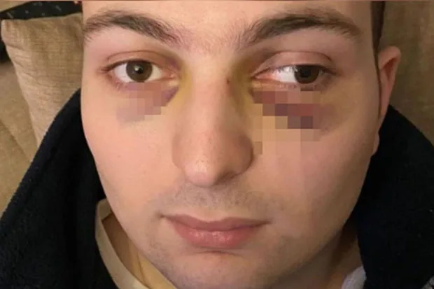 Ticarət mərkəzində döyülən oğlanla bağlı araşdırma BAŞLADI