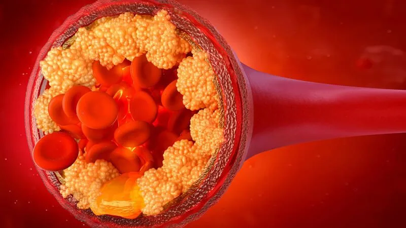 Xolesterolu aşağı salan qidalar açıqlandı