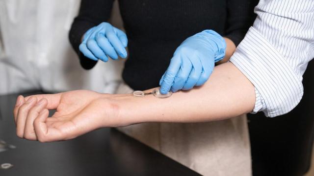 İnfeksiyaları günlər əvvəl aşkar edən ağıllı sarğı: iCares