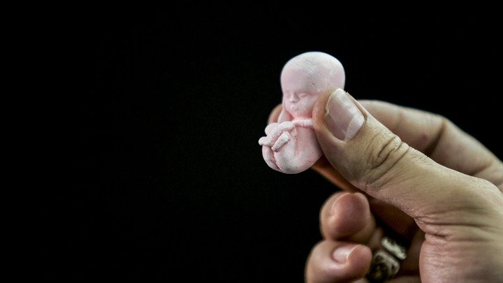 Qanunsuz aborta görə cəzalar sərtləşdirilir
