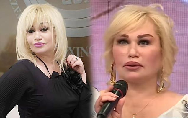 “Plastik əməliyyatda sinirimə toxunulub” - Sevda Kazımova