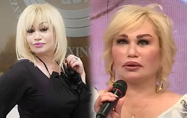 “Plastik əməliyyatda sinirimə toxunulub” - Sevda Kazımova