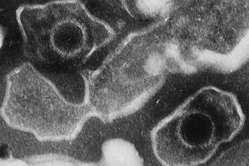 Bu virus xərçəng riskini artırır