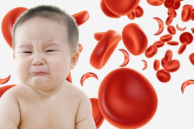 Uşağınızın qanazlığından şübhələnirsinizsə… -  Həkimdən valideynlərə ÇAĞIRIŞ