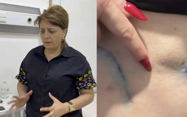 Daha bir “plastik cərrah” qalmaqalı - “Bədənim çürüyür”+ VİDEO