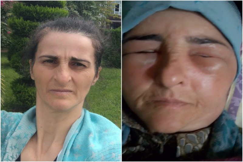 Lənkəranda qonşular arasında dava - xəsarət alan var