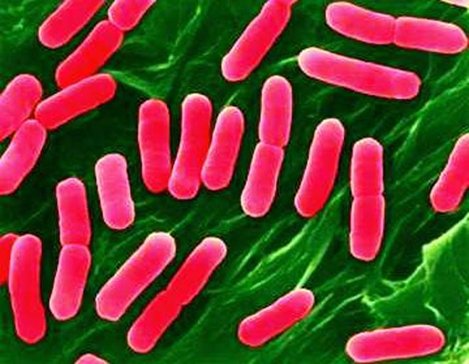 Antibiotiklərin çoxu bakterial infeksiyalara qarşı effektivliyini itirib – ÜST