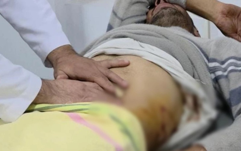 Qubada ayı hücumu olub, xəsarət alan var