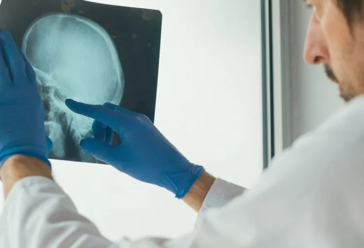 Daha çox bu xəstələr insult risk qrupuna daxildir