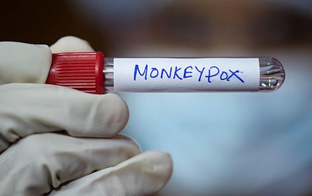 ÜST-dən meymunçiçəyi ilə bağlı - Xəbərdarlıq