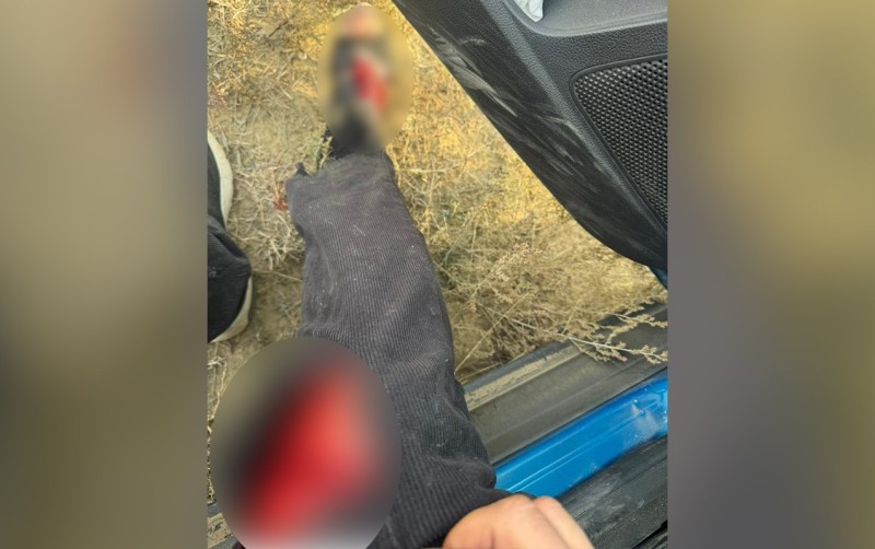 AzTV-nin müxbiri xəsarət aldı - FOTO