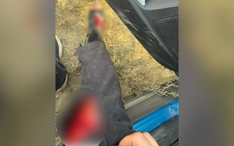 AzTV-nin müxbiri xəsarət aldı - FOTO