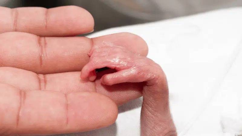 Tibb Mərkəzin həyətində ölü döl tapıldı 