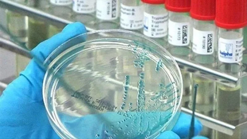 ÜST xəbərdarlıq etdi: Bu virus sürətlə yayılır!