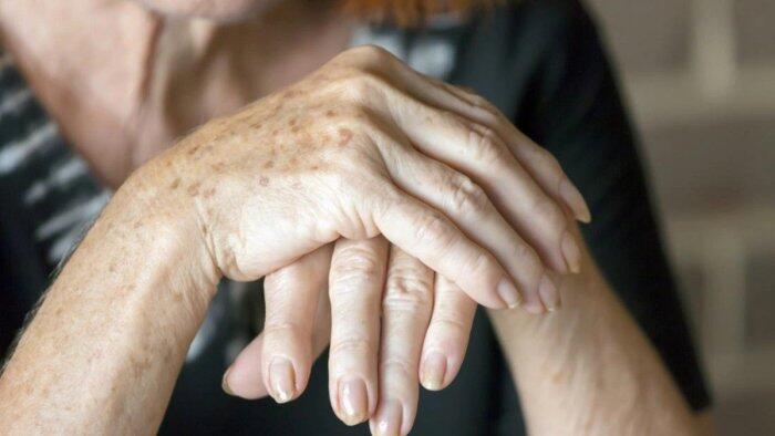 Əllərin dərisini necə cavanlaşdırmaq olar? -Yaşınızı ələ verməsin