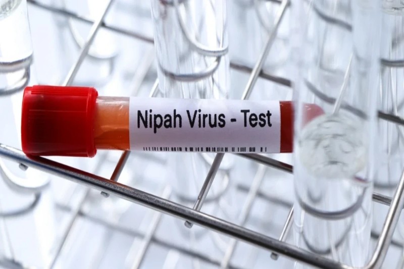 Nipah virusunun yayılma riski azdır - ÜST