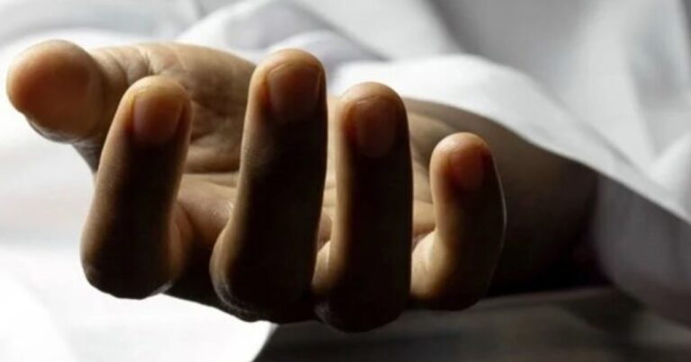 Kişi ehtiyatsızlıqdan yanaraq öldü