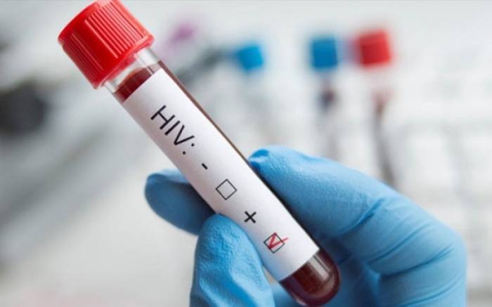 Azərbaycanda İİV-ə yoluxma sayı azalıb - RƏSMİ