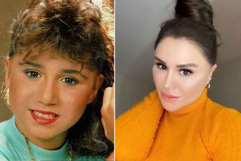 Estetik əməliyyatla dəyişən MƏŞHURLAR