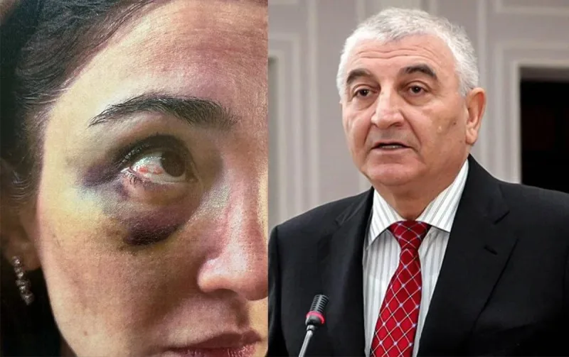 Keçmiş gəlinindən Məzahir Pənahova İTTİHAM: "Zinət əşyalarımı..."