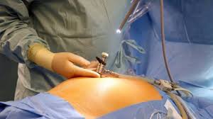 Həkimdən TƏCİLİ xəbərdarlıq: Həyati təhlükə ola bilər