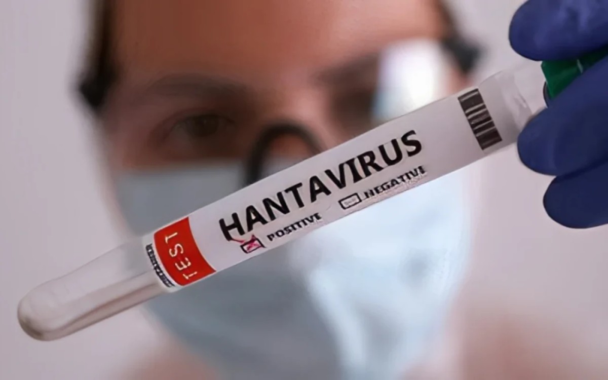 Azərbaycanda hantavirusa yoluxma qeydə alınıb?