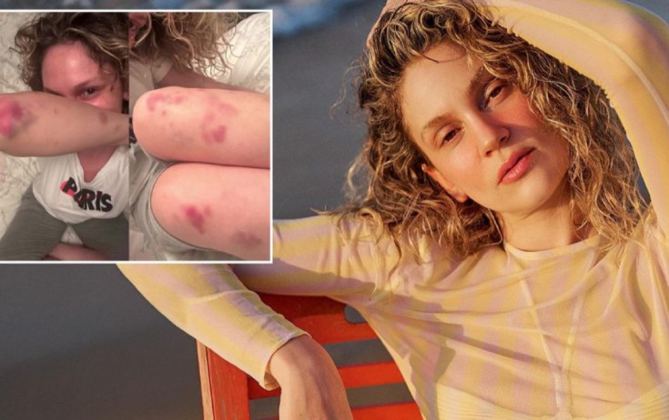 Farah Zeynep Abdullaha nə olub? - Foto