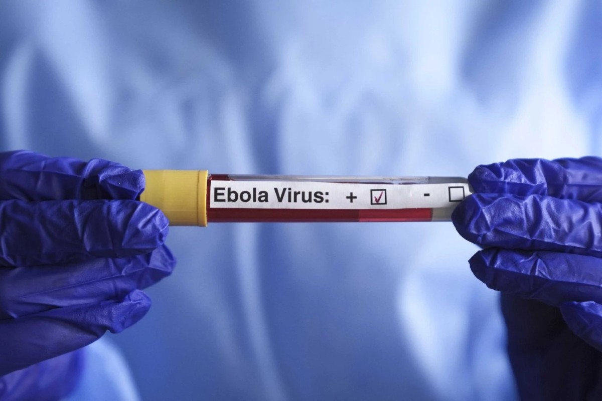 ÜST-dən Ebola xəbərdarlığı: Virusu idarə edə bilmirik