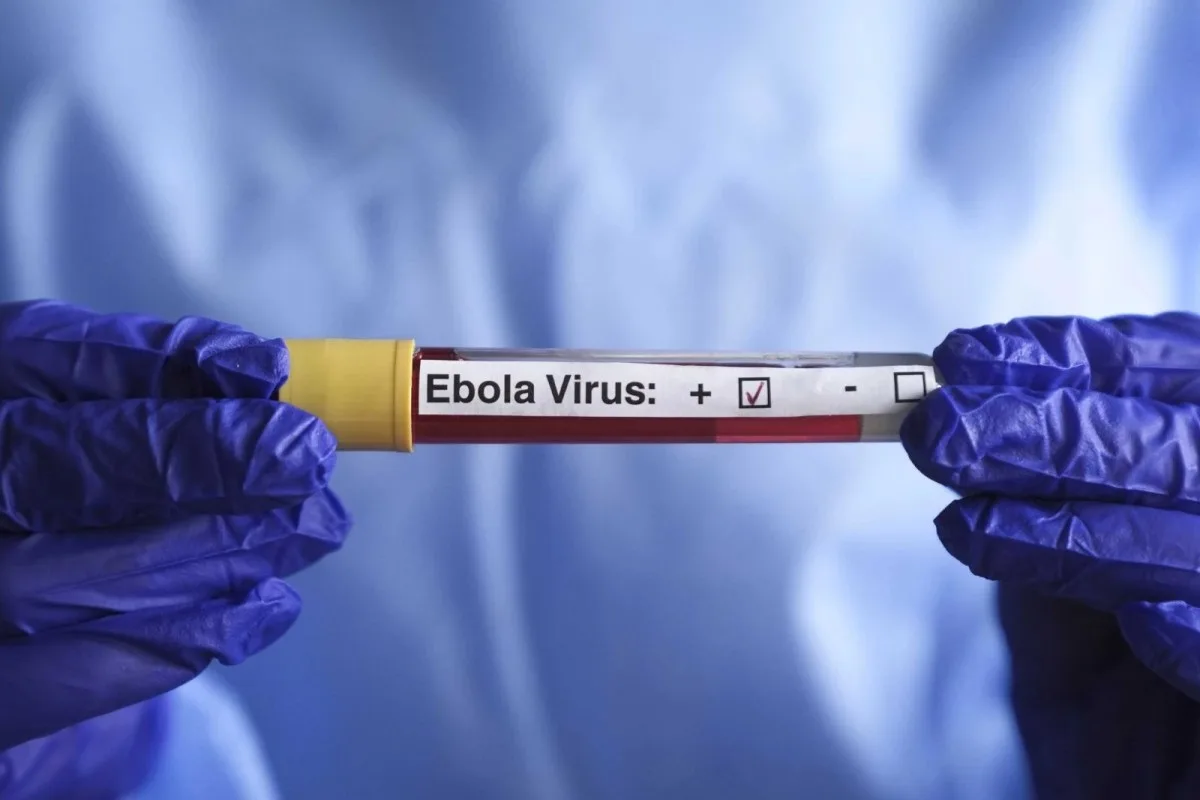 ÜST-dən Ebola xəbərdarlığı: Virusu idarə edə bilmirik