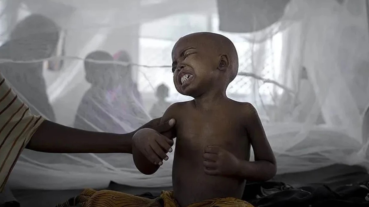 Nigeriyada vəba qurbanlarının sayı artır