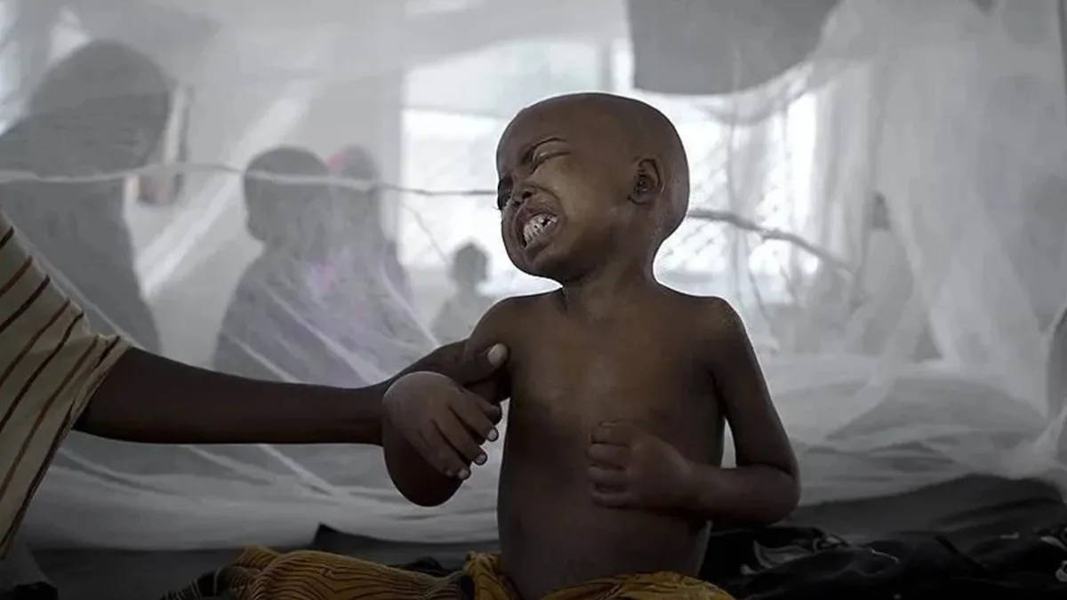 Nigeriyada vəba qurbanlarının sayı artır